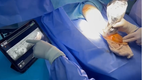 إنجاز طبي جديد في تونس